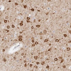 C9orf50 Antibody, Novus Biologicals 25 &mu;L, Unlabeled:Antibodies, Polyclonal