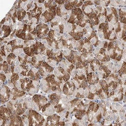 TMEM245 Antibody, Novus Biologicals 25 &mu;L | Buy Online | Novus Biologicals | Fisher Scientific