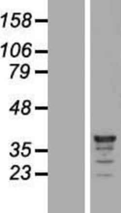 Novus Biologicals&trade;&nbsp;HCA59 Overexpression Lysate