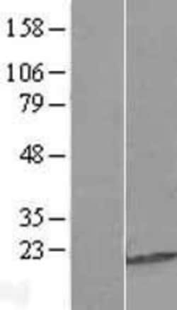 Novus Biologicals&trade;&nbsp;C9orf85 Overexpression Lysate