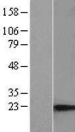 Novus Biologicals™ C9orf9 Overexpression Lysate