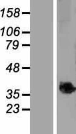 Novus Biologicals&trade;&nbsp;TMEM268 Overexpression Lysate