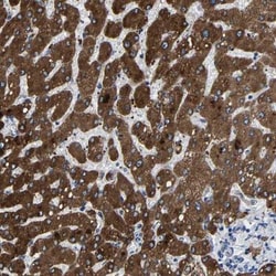 CCDC171 Antibody, Novus Biologicals:Antibodies:Primary Antibodies