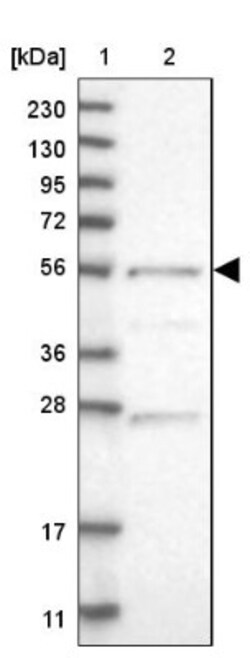 Adenylate Kinase 8 Antibody, Novus Biologicals 0.1mL; Unlabeled:Antibodies,