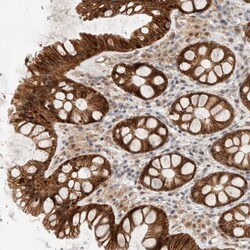 Adenylate Kinase 8 Antibody, Novus Biologicals:Antibodies:Primary Antibodies