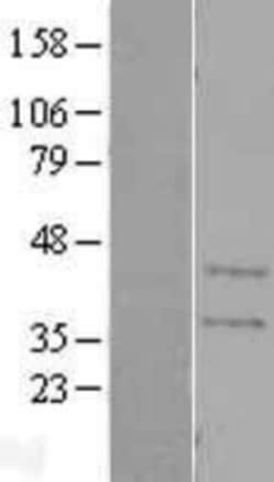 Novus Biologicals&trade;&nbsp;CA11 Overexpression Lysate