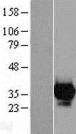 Novus Biologicals&trade;&nbsp;Carbonic Anhydrase VII/CA7 Overexpression Lysate