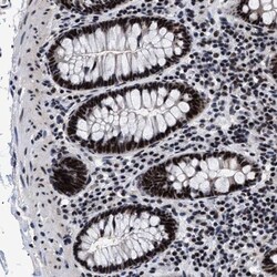 CAAP1 Antibody, Novus Biologicals:Antibodies:Primary Antibodies
