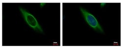 CAB39 Antibody, Novus Biologicals 0.1mL; Unlabeled:Antibodies, Polyclonal