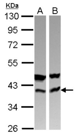 CAB39 Antibody, Novus Biologicals 0.1mL; Unlabeled:Antibodies, Polyclonal