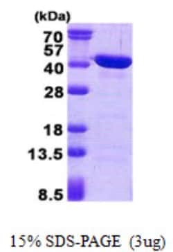 Novus Biologicals&trade;&nbsp;Recombinant Human CAB39L His Protein
