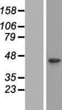 Novus Biologicals&trade;&nbsp;CABLES1 Overexpression Lysate