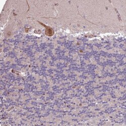 CABP1 Antibody, Novus Biologicals:Antibodies:Primary Antibodies