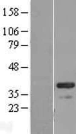 Novus Biologicals&trade;&nbsp;CABP4 Overexpression Lysate