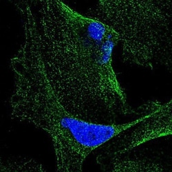 CABP5 Antibody, Novus Biologicals 0.1mL; Unlabeled:Antibodies, Polyclonal