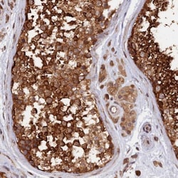 CABP5 Antibody, Novus Biologicals 0.1mL; Unlabeled:Antibodies, Polyclonal