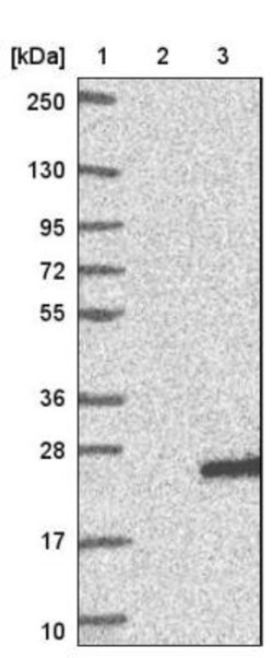 CABP5 Antibody, Novus Biologicals 0.1mL; Unlabeled:Antibodies, Polyclonal