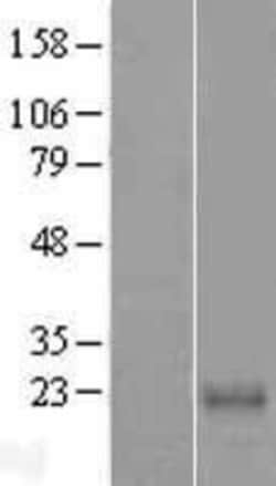 Novus Biologicals&trade;&nbsp;CABP7 Overexpression Lysate