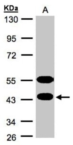 CABS1 Antibody, Novus Biologicals 0.1mg; Unlabeled:Antibodies, Polyclonal