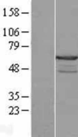 Novus Biologicals&trade;&nbsp;CABS1 Overexpression Lysate