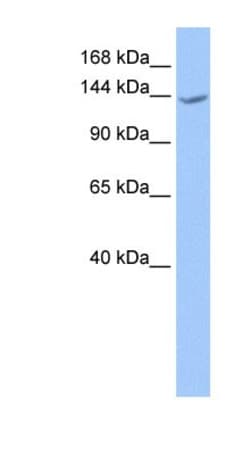 CACHD1 Antibody, Novus Biologicals 20μL; Unlabeled:Antibodies, Polyclonal