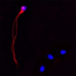 CACNA1I Antibody - Azide and BSA Free, Novus Biologicals 0.1 mg | Buy Online | Novus Biologicals | Fisher Scientific