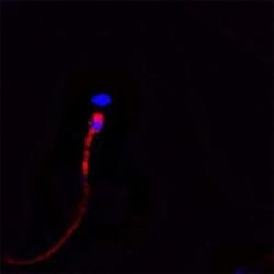 CACNA1I Antibody - Azide and BSA Free, Novus Biologicals 0.1 mg | Buy Online | Novus Biologicals | Fisher Scientific