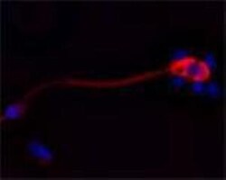 CACNA1I Antibody - Azide and BSA Free, Novus Biologicals 0.1 mg | Buy Online | Novus Biologicals | Fisher Scientific