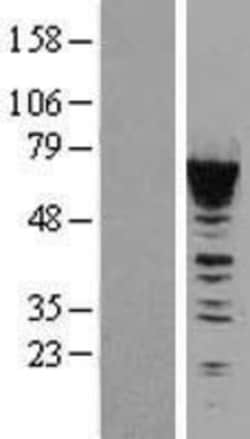 Novus Biologicals&trade;&nbsp;CACNB1 Overexpression Lysate