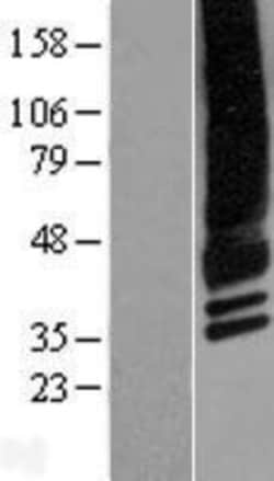 Novus Biologicals&trade;&nbsp;CACNG4 Overexpression Lysate