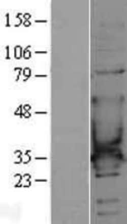 Novus Biologicals&trade;&nbsp;CACNG6 Overexpression Lysate