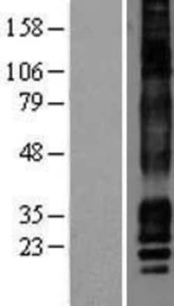 Novus Biologicals&trade;&nbsp;CACNG7 Overexpression Lysate