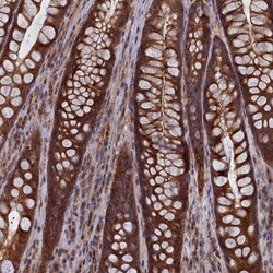 Cactin Antibody, Novus Biologicals:Antibodies:Primary Antibodies