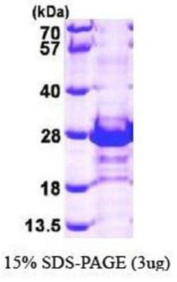 Novus Biologicals&trade;&nbsp;Recombinant Human CACYBP His Protein