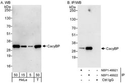 CACYBP Antibody, Novus Biologicals 0.1mL; Unlabeled:Antibodies, Polyclonal