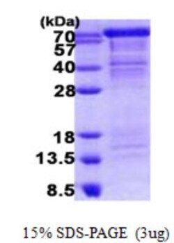 Novus Biologicals&trade;&nbsp;Recombinant Human Cadherin-11 His Protein