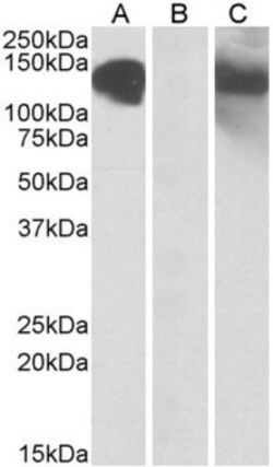 Cadherin-11 Antibody, Novus Biologicals 0.1mg; Unlabeled:Antibodies, Polyclonal