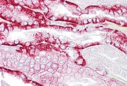 Cadherin-16 Antibody, Novus Biologicals 0.05mg; Unlabeled:Antibodies, Polyclonal