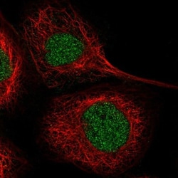 Cadherin-17 Antibody, Novus Biologicals:Antibodies:Primary Antibodies