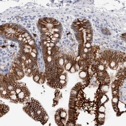 Cadherin-17 Antibody, Novus Biologicals:Antibodies:Primary Antibodies