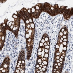Cadherin-17 Antibody, Novus Biologicals 0.1mL; Unlabeled:Antibodies, Polyclonal