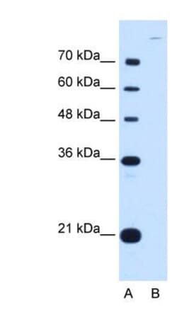 Cadherin-7 Antibody, Novus Biologicals 100&mu;L; Unlabeled:Antibodies,