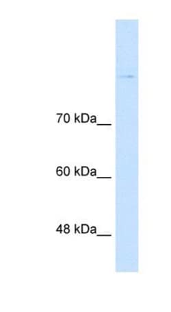 Cadherin-8 Antibody, Novus Biologicals 100μL; Unlabeled:Antibodies,