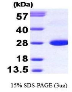 Novus Biologicals&trade;&nbsp;Recombinant Human Calbindin D-28K Protein
