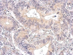 Calcineurin A Antibody, Novus Biologicals 0.1mL; Unlabeled:Antibodies