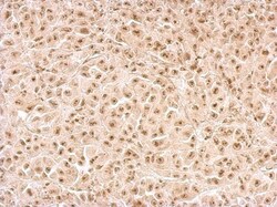 Calcineurin A Antibody, Novus Biologicals 0.1mL; Unlabeled:Antibodies