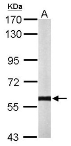 Calcineurin A Antibody, Novus Biologicals 0.1mL; Unlabeled:Antibodies