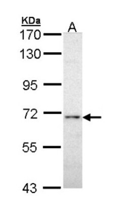 Calcineurin A Antibody, Novus Biologicals 0.1mL; Unlabeled:Antibodies