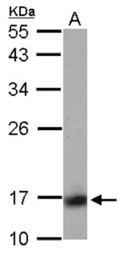 Calcineurin B Antibody, Novus Biologicals 0.1mL; Unlabeled:Antibodies,