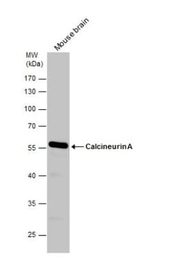 Calcineurin A Antibody, Novus Biologicals 0.1mL; Unlabeled:Antibodies
